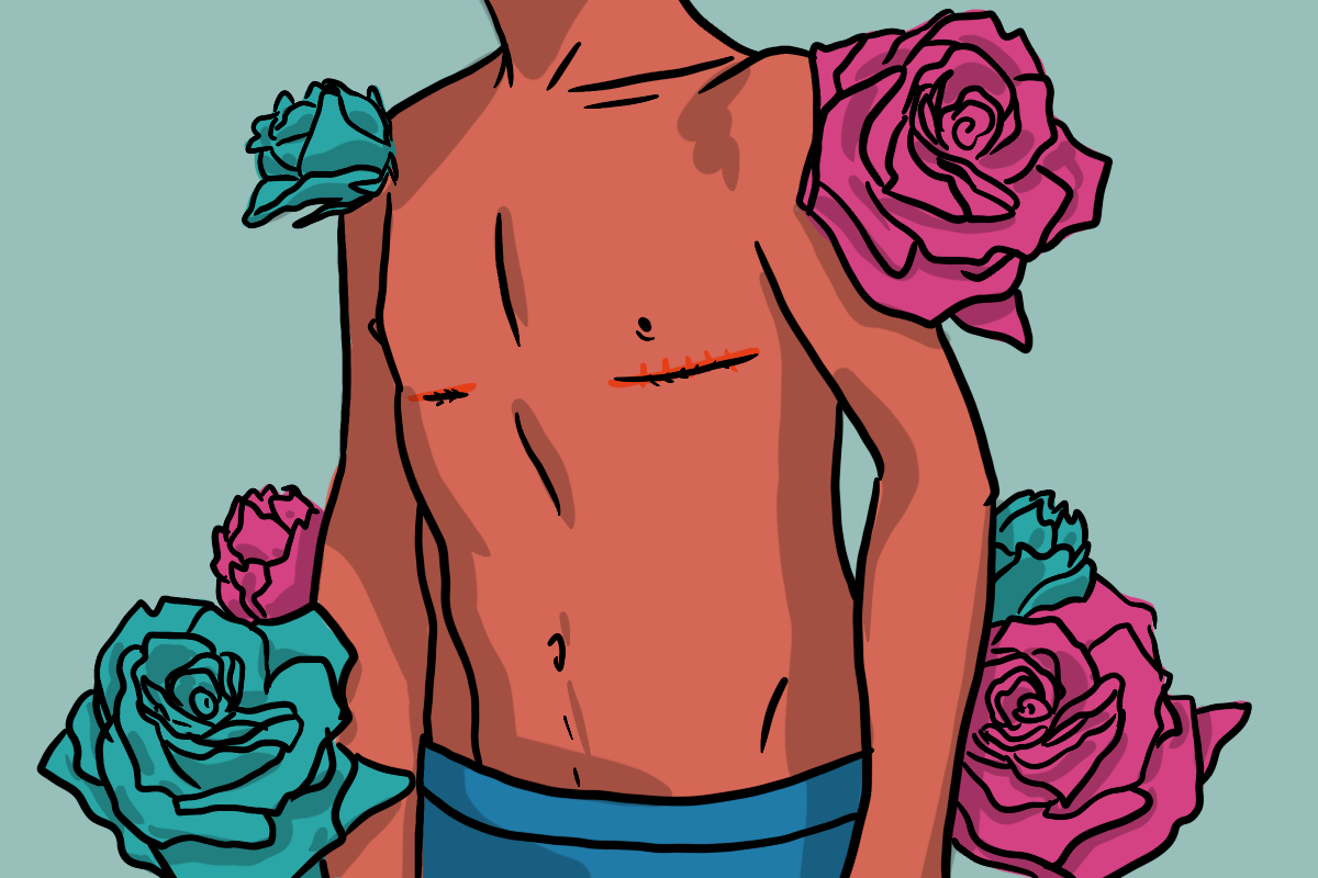 Pessoas trans relatam demora na fila do SUS para cirurgia de redesignação sexual - Agência Mural de Jornalismo das Periferias